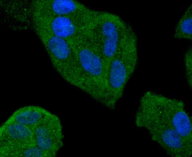 SMAD4 Antibody in Immunocytochemistry (ICC/IF)