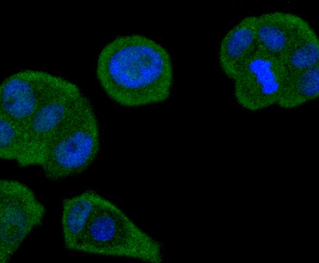 SMAD4 Antibody in Immunocytochemistry (ICC/IF)