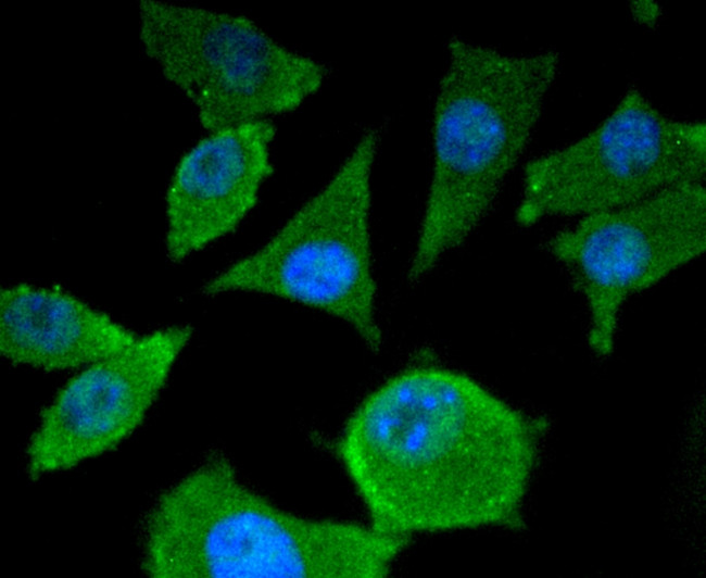 SMAD4 Antibody in Immunocytochemistry (ICC/IF)