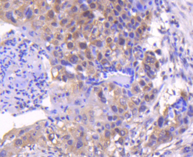 SMAD4 Antibody in Immunohistochemistry (Paraffin) (IHC (P))