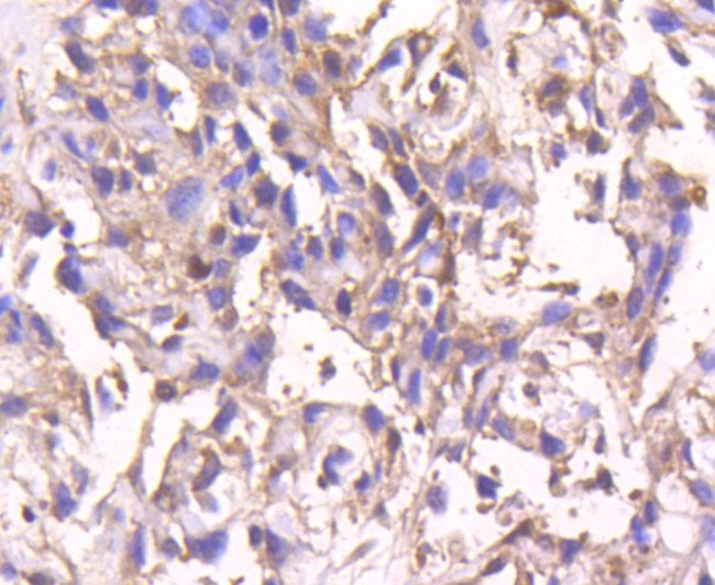 SMAD4 Antibody in Immunohistochemistry (Paraffin) (IHC (P))