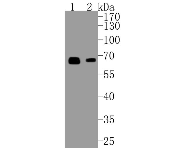 SMAD4 Antibody in Western Blot (WB)