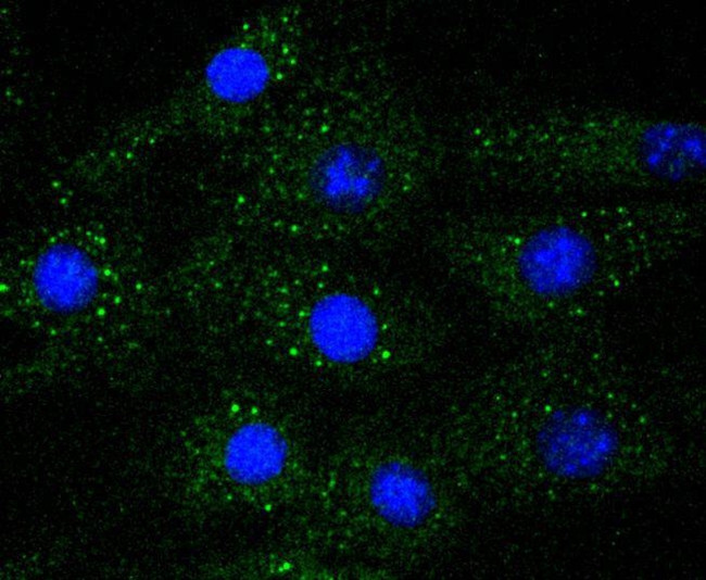 ERK1 Antibody in Immunocytochemistry (ICC/IF)