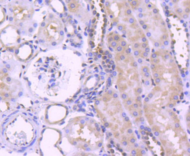 ERK1 Antibody in Immunohistochemistry (Paraffin) (IHC (P))