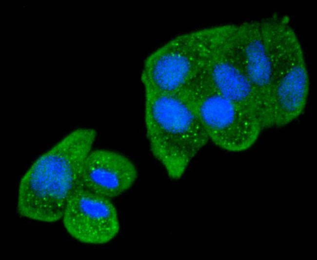 SMAD2 Antibody in Immunocytochemistry (ICC/IF)