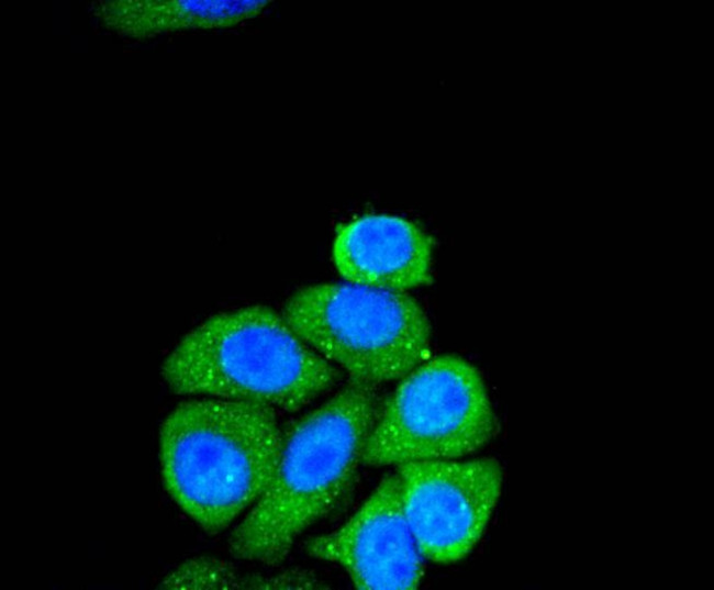 SMAD2 Antibody in Immunocytochemistry (ICC/IF)