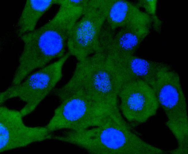 SMAD2 Antibody in Immunocytochemistry (ICC/IF)