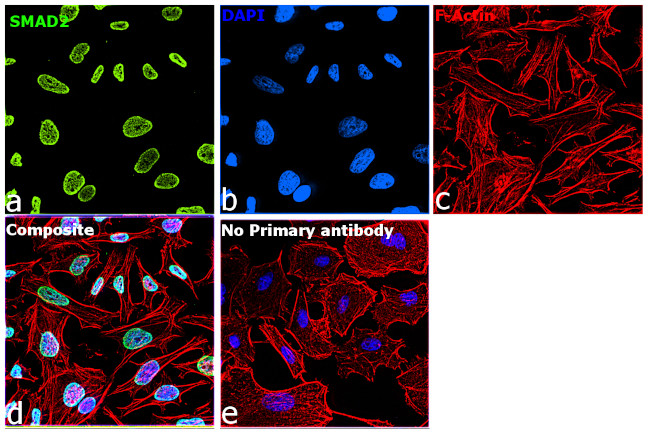 SMAD2 Antibody in Immunocytochemistry (ICC/IF)