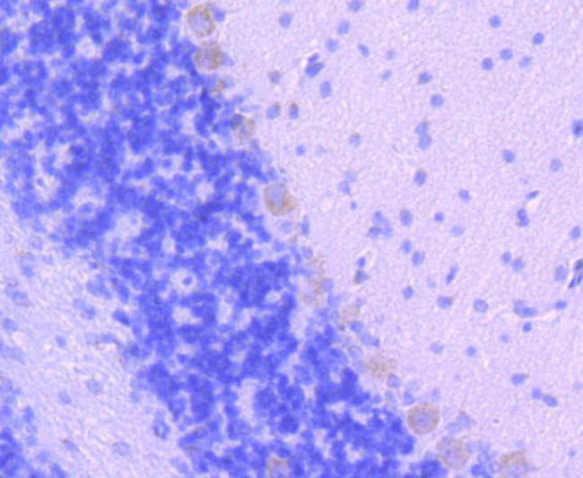 SMAD2 Antibody in Immunohistochemistry (Paraffin) (IHC (P))