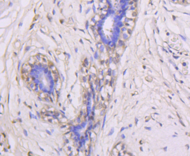 ERK1 Antibody in Immunohistochemistry (Paraffin) (IHC (P))