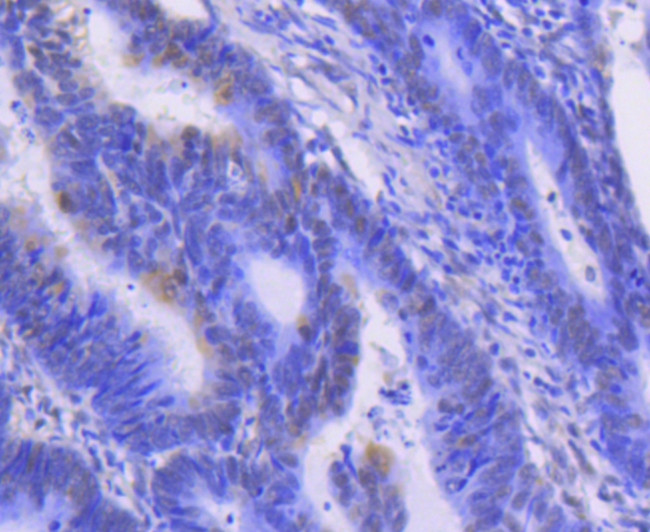 ERK1 Antibody in Immunohistochemistry (Paraffin) (IHC (P))