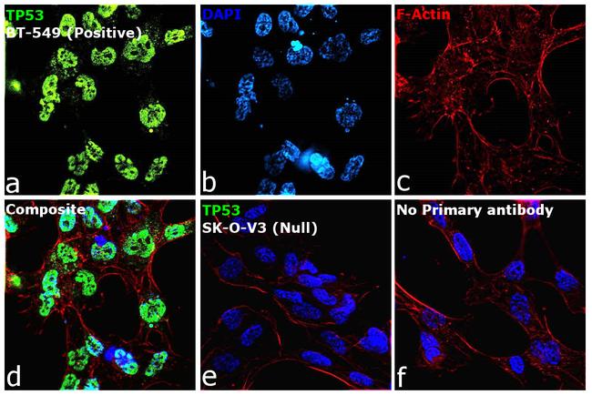 p53 Antibody in Immunocytochemistry (ICC/IF)