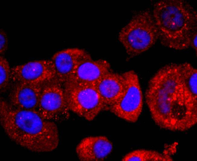 p53 Antibody in Immunocytochemistry (ICC/IF)