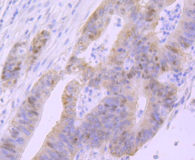 p53 Antibody in Immunohistochemistry (Paraffin) (IHC (P))