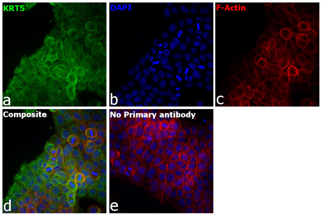 Cytokeratin 5 Antibody in Immunocytochemistry (ICC/IF)