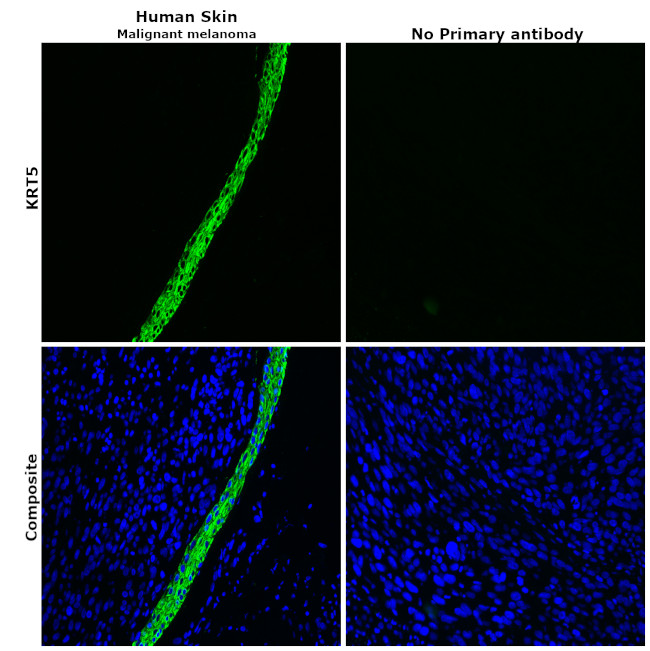 Cytokeratin 5 Antibody in Immunohistochemistry (Paraffin) (IHC (P))