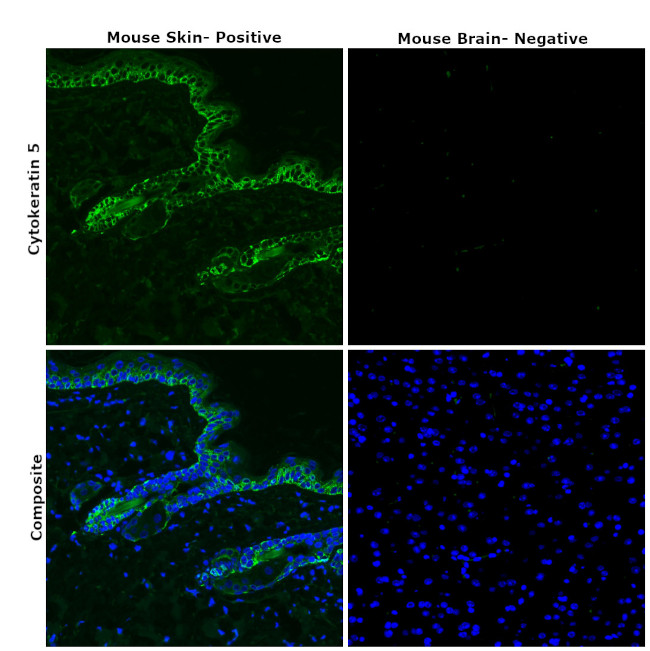 Cytokeratin 5 Antibody in Immunohistochemistry (Paraffin) (IHC (P))