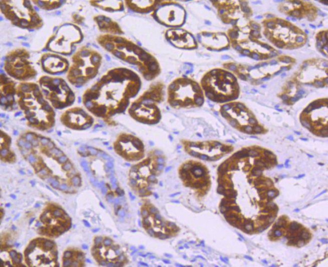 ALDH1A1 Antibody in Immunohistochemistry (Paraffin) (IHC (P))