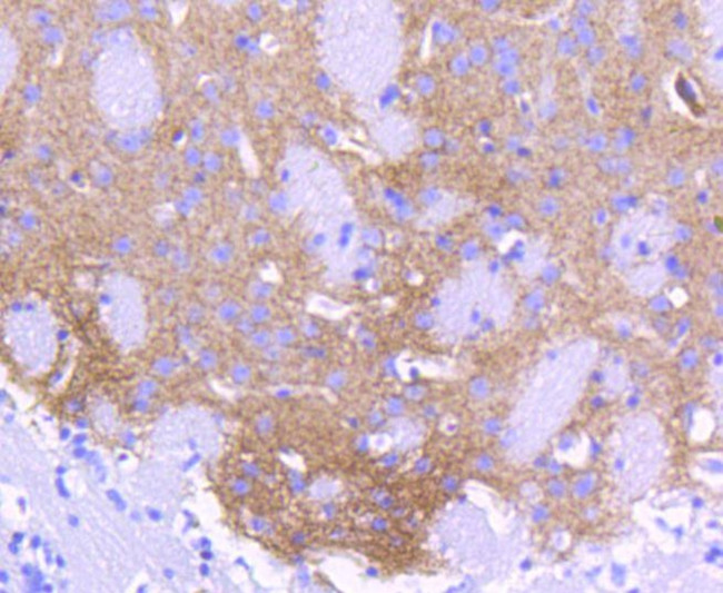 ALDH1A1 Antibody in Immunohistochemistry (Paraffin) (IHC (P))