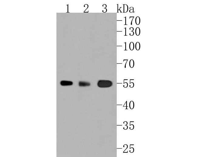 ALDH1A1 Antibody in Western Blot (WB)