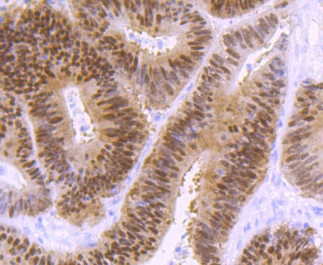 CDX2 Antibody in Immunohistochemistry (Paraffin) (IHC (P))