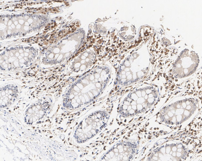 STAT1 Antibody in Immunohistochemistry (Paraffin) (IHC (P))