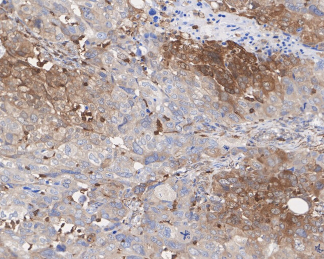 STAT1 Antibody in Immunohistochemistry (Paraffin) (IHC (P))