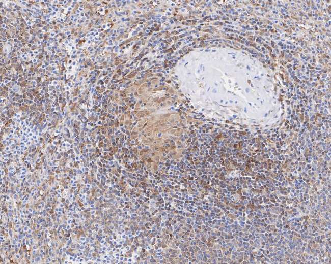 STAT1 Antibody in Immunohistochemistry (Paraffin) (IHC (P))