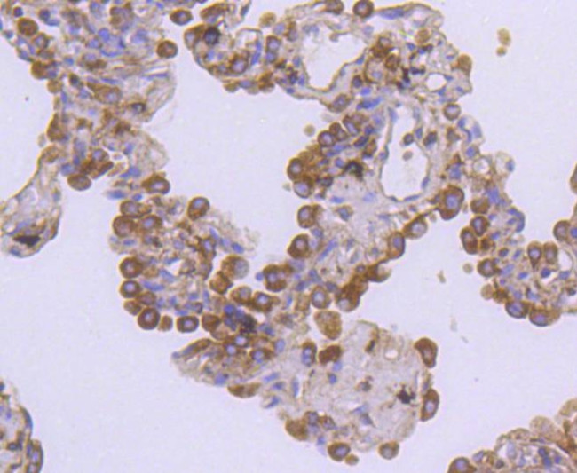 c-Met Antibody in Immunohistochemistry (Paraffin) (IHC (P))