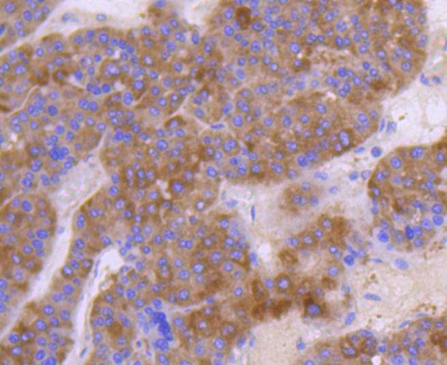 c-Met Antibody in Immunohistochemistry (Paraffin) (IHC (P))