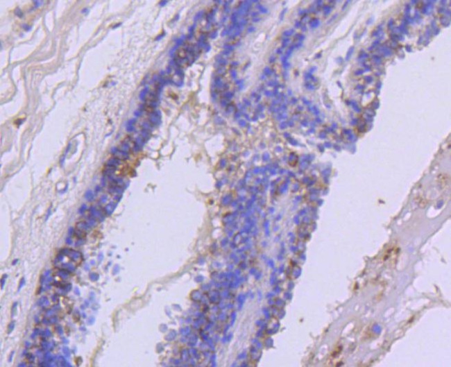 c-Met Antibody in Immunohistochemistry (Paraffin) (IHC (P))