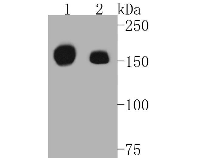 c-Met Antibody in Western Blot (WB)