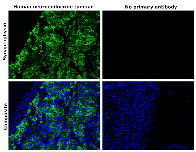 Synaptophysin Antibody in Immunohistochemistry (Paraffin) (IHC (P))