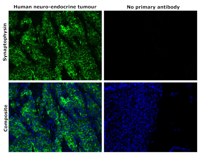 Synaptophysin Antibody in Immunohistochemistry (Paraffin) (IHC (P))