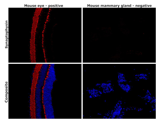 Synaptophysin Antibody in Immunohistochemistry (Paraffin) (IHC (P))