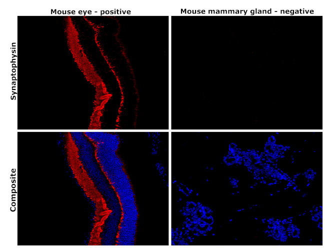 Synaptophysin Antibody in Immunohistochemistry (Paraffin) (IHC (P))