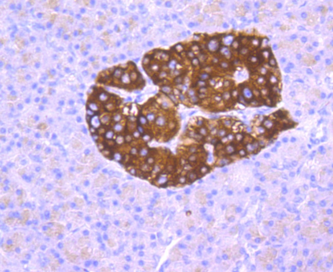 Synaptophysin Antibody in Immunohistochemistry (Paraffin) (IHC (P))