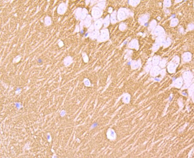 Synaptophysin Antibody in Immunohistochemistry (Paraffin) (IHC (P))