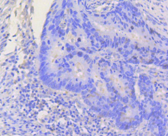 STAT3 Antibody in Immunohistochemistry (Paraffin) (IHC (P))