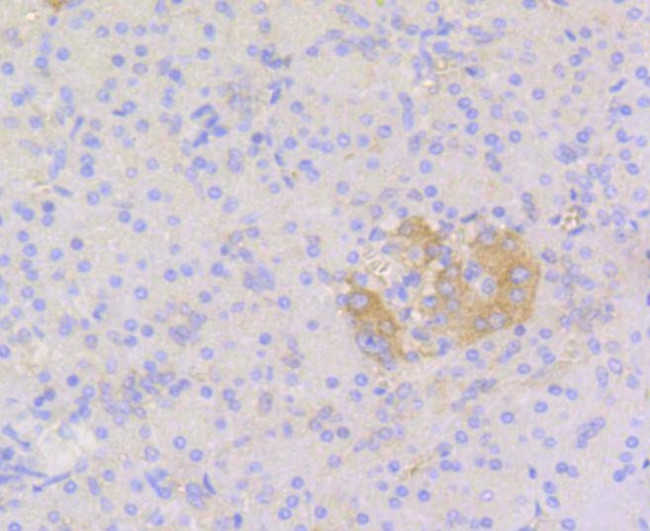 STAT3 Antibody in Immunohistochemistry (Paraffin) (IHC (P))