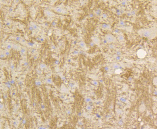 STAT3 Antibody in Immunohistochemistry (Paraffin) (IHC (P))