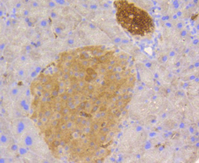 STAT3 Antibody in Immunohistochemistry (Paraffin) (IHC (P))