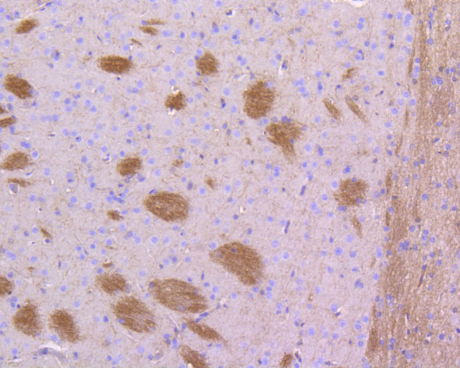 STAT3 Antibody in Immunohistochemistry (Paraffin) (IHC (P))