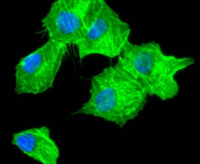 Alpha-Smooth Muscle Actin Antibody in Immunocytochemistry (ICC/IF)