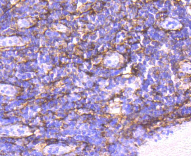 Alpha-Smooth Muscle Actin Antibody in Immunohistochemistry (Paraffin) (IHC (P))