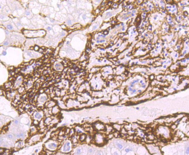 Alpha-Smooth Muscle Actin Antibody in Immunohistochemistry (Paraffin) (IHC (P))