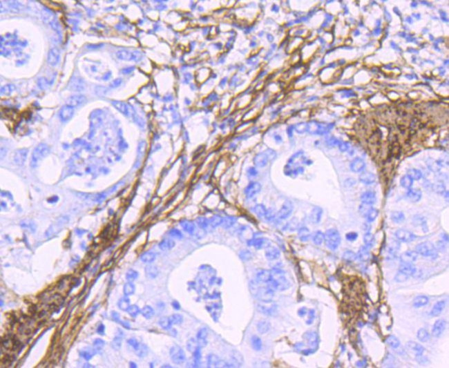 Alpha-Smooth Muscle Actin Antibody in Immunohistochemistry (Paraffin) (IHC (P))