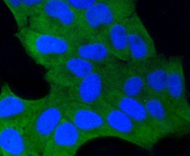 GSK3B Antibody in Immunocytochemistry (ICC/IF)