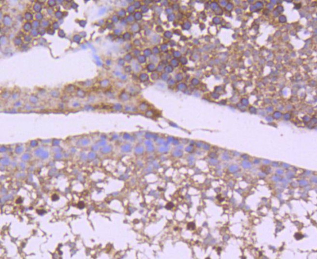 GSK3B Antibody in Immunohistochemistry (Paraffin) (IHC (P))