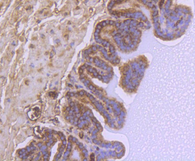 GSK3B Antibody in Immunohistochemistry (Paraffin) (IHC (P))